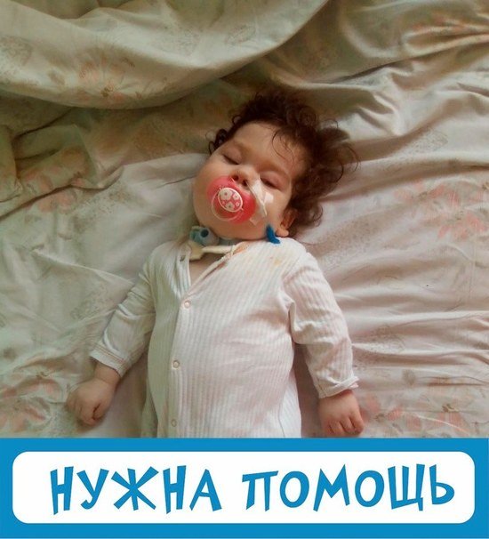 Объявлен сбор для годовалой калининградки, которая не может дышать и питаться самостоятельно - Новости Калининграда | Фото: "Верю в чудо" Объявлен сбор для годовалой калининградки, которая не может дышать и питаться самостоятельно - Новости Калининграда | Фото: "Верю в чудо"
