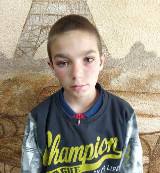 В Гусеве пропал 11-летний воспитанник социального центра "Росток" - Новости Калининграда | Фото: пресс-служба регионального УМВД В Гусеве пропал 11-летний воспитанник социального центра "Росток" - Новости Калининграда | Фото: пресс-служба регионального УМВД