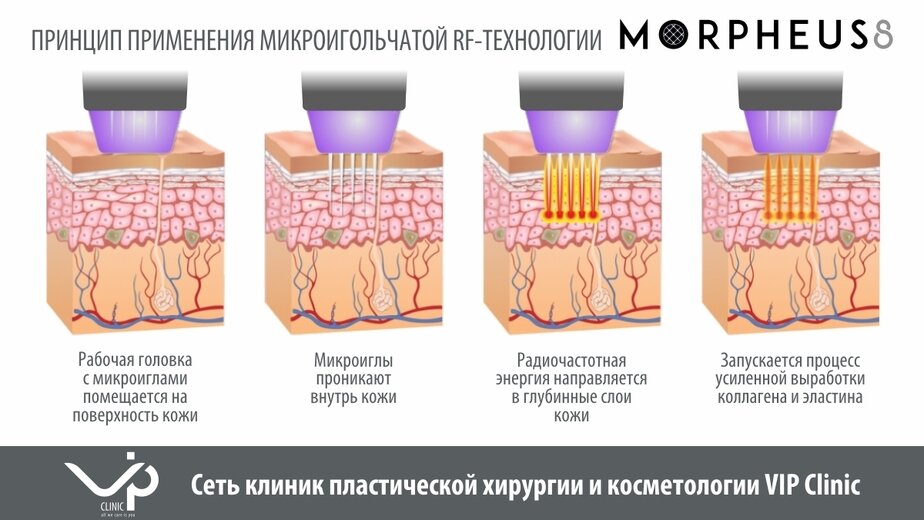 Какие отличия существуют в использовании процедуры reset при открытии различных типов файлов