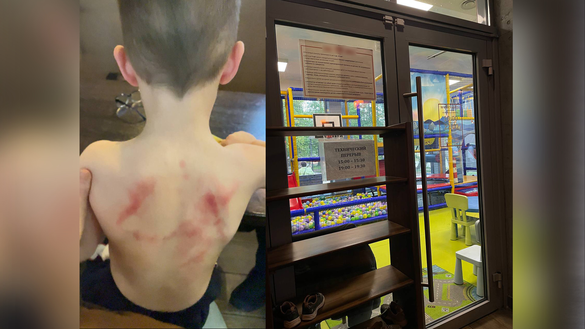 Мальчик пострадал в игровой комнате кафе