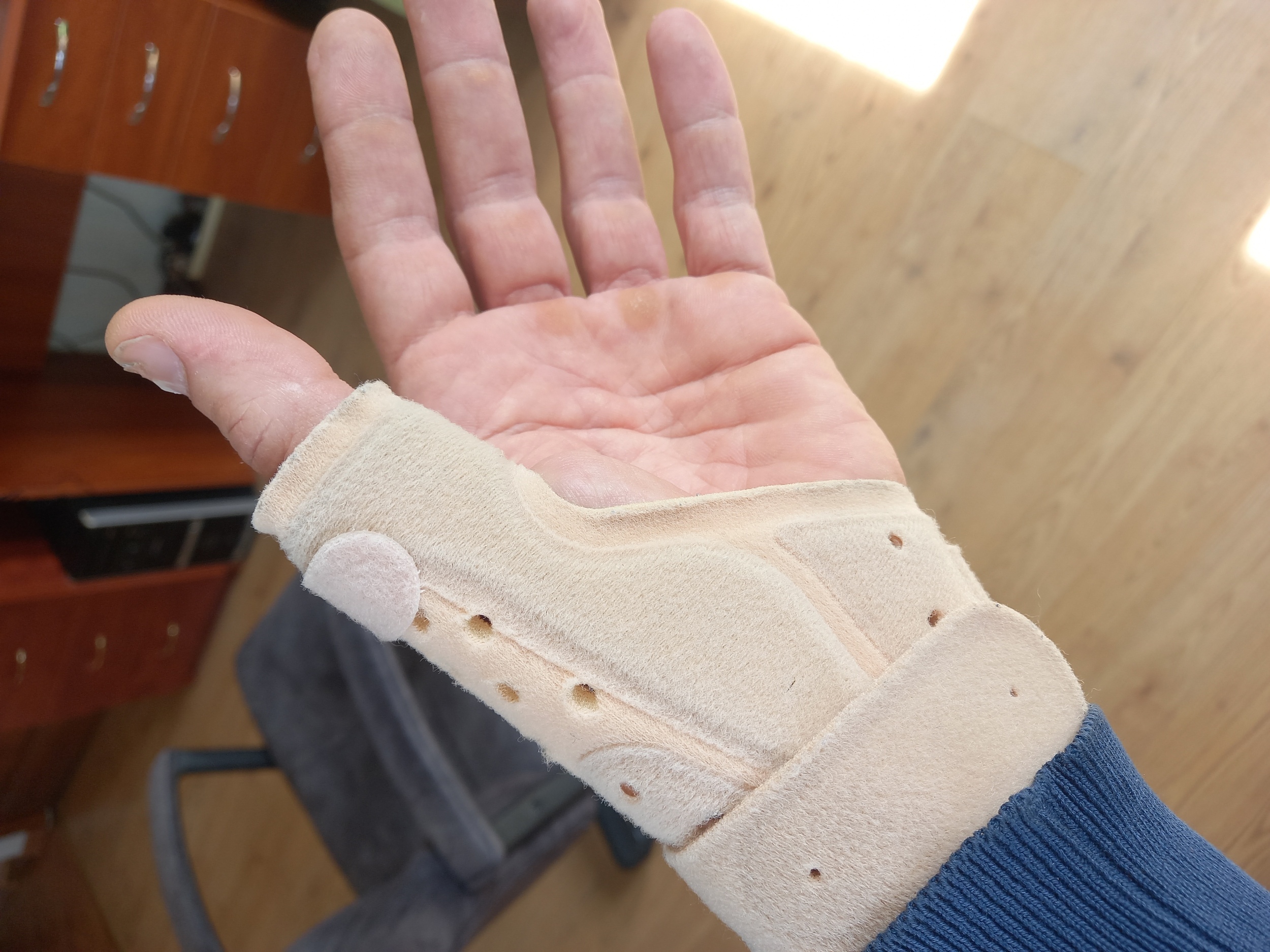 У мужчины после избиения травма запястья